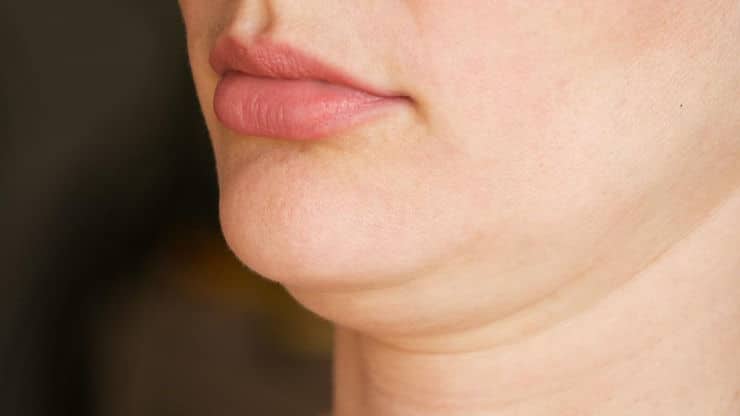 Say Goodbye to Your Double Chin with Agnes RF