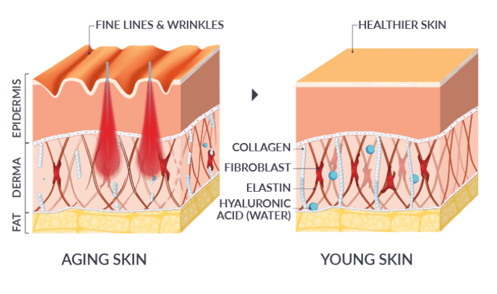 Vein treatments for varicose veins