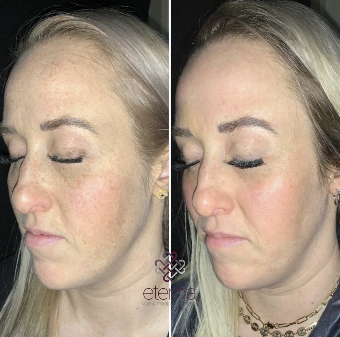 Before and After Image: Moxi - left-front-oblique